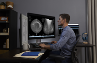 Hologic’s AI-Powered Mammography Technology
